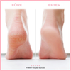 Nirelle FootShine™ - Mjuka och fina fötter på nolltid