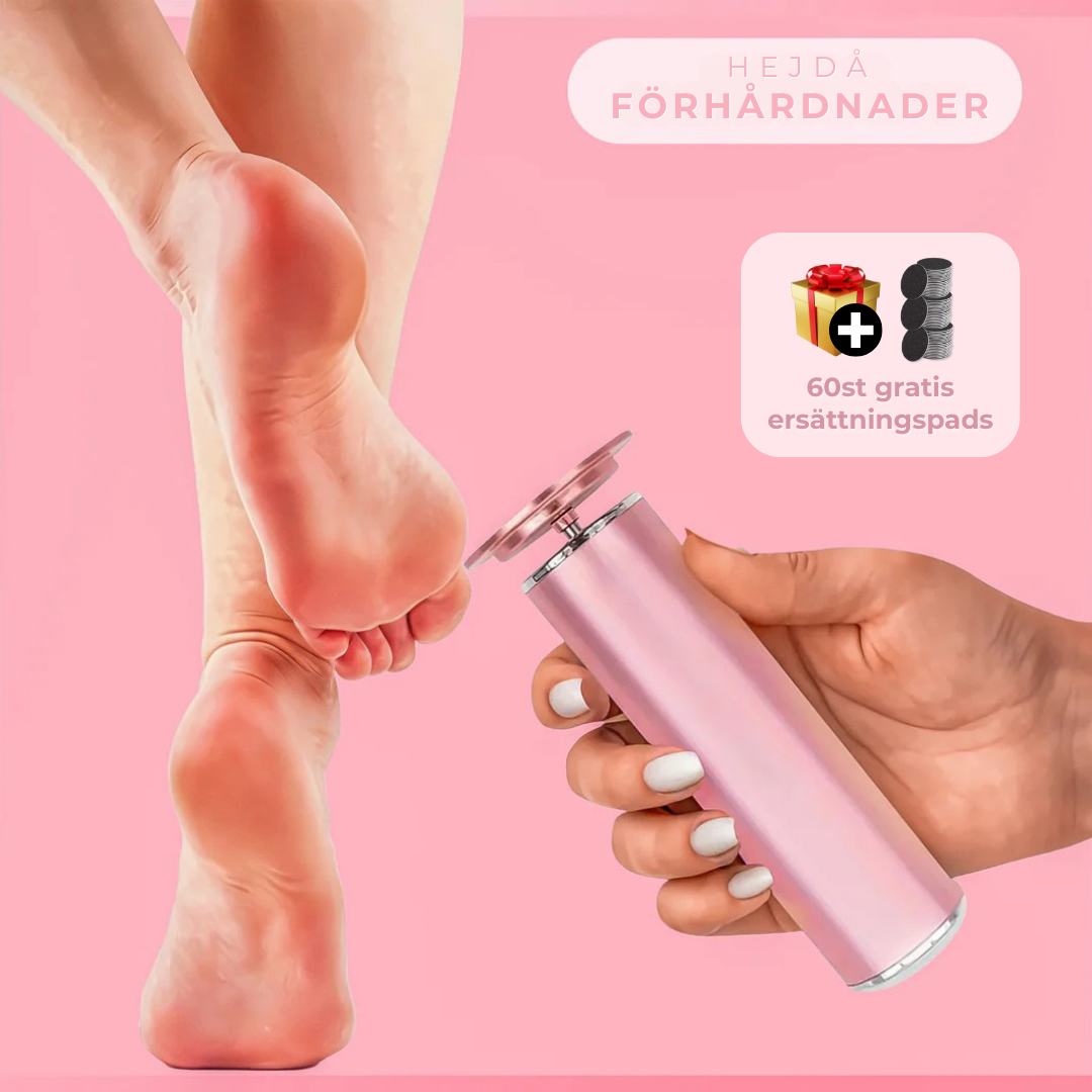 Nirelle FootShine™ - Mjuka och fina fötter på nolltid